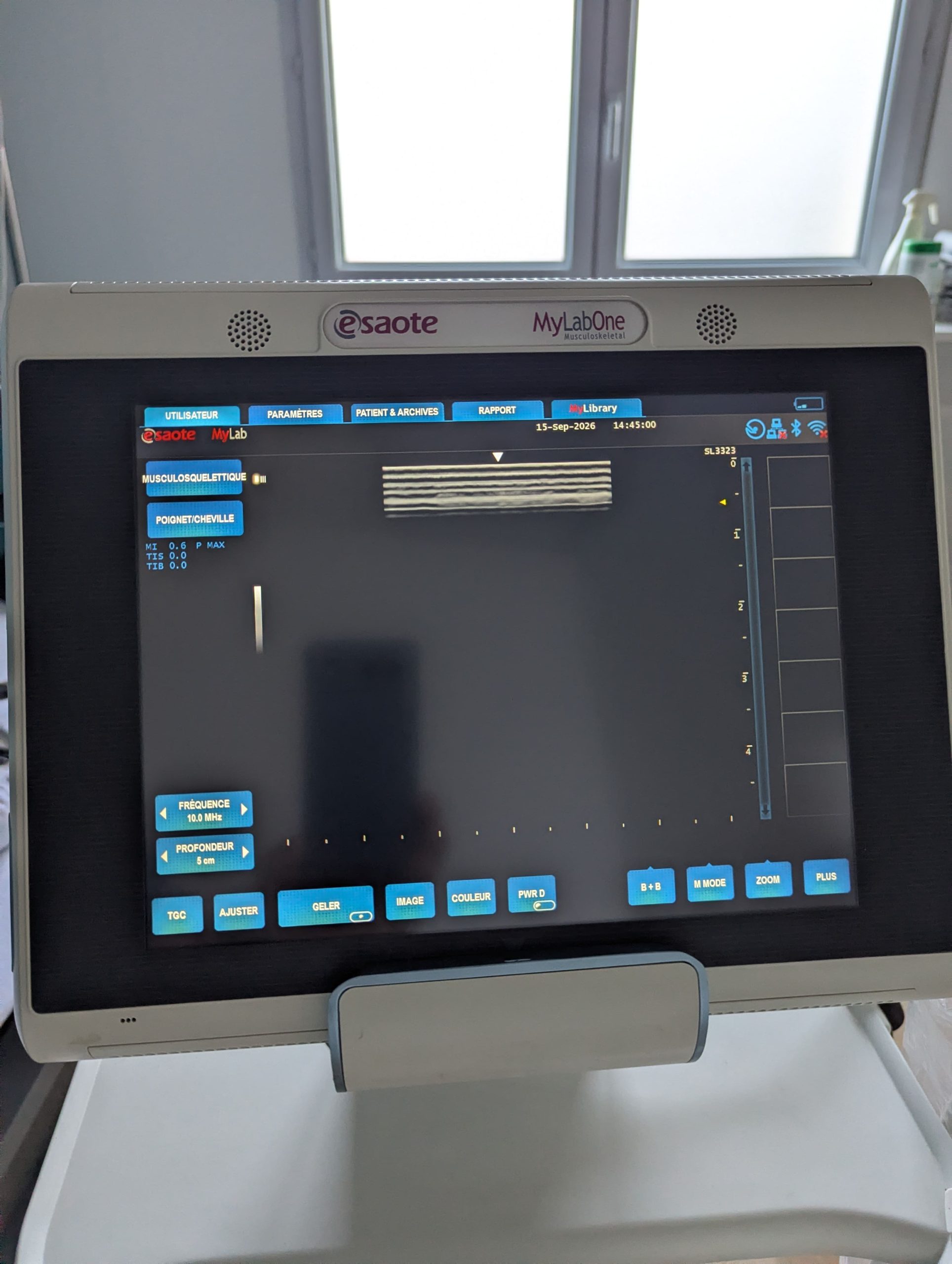 Echographe ESAOTE MYLAB ONE - image 3